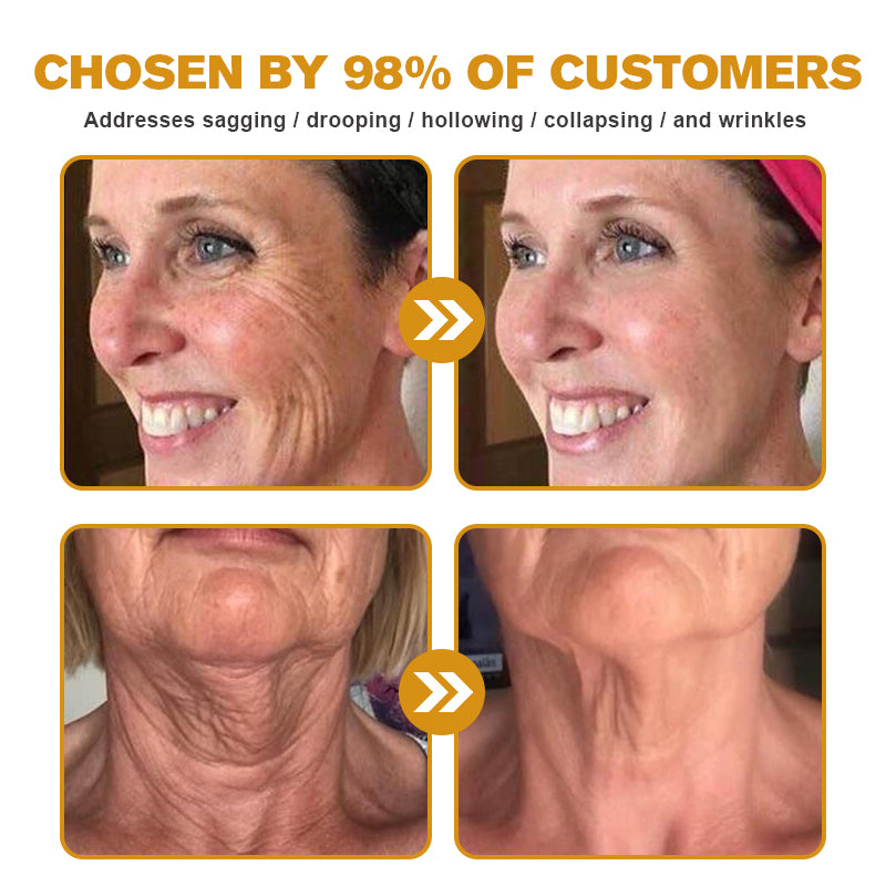 💎🍀Made and Shipped from the USA ✅Furzero™ Botox Bee Venom Wrinkle Removal Cream-Last Day Promotion 70% OFF