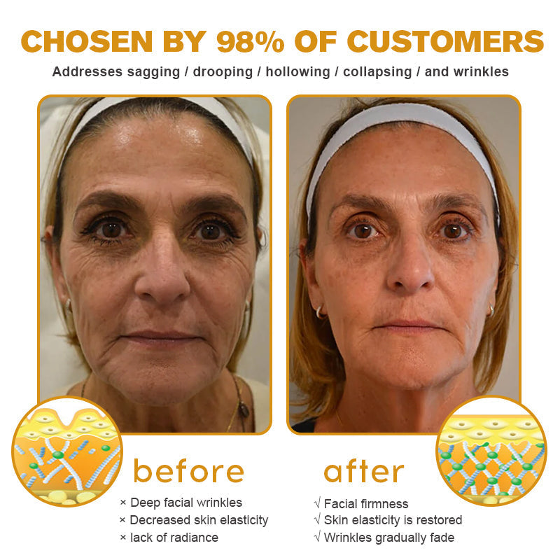 💎🍀Made and Shipped from the USA ✅Furzero™ Botox Bee Venom Wrinkle Removal Cream-Last Day Promotion 70% OFF