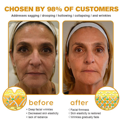 💎🍀Made and Shipped from the USA ✅Furzero™ Botox Bee Venom Wrinkle Removal Cream-Last Day Promotion 70% OFF